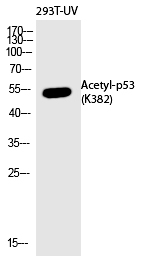 p53 (Acetyl-Lys382) Polyclonal Antibody