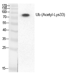 Ub (Acetyl-Lys33) Polyclonal Antibody