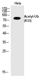 Ub (Acetyl-Lys33) Polyclonal Antibody