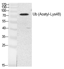 Ub (Acetyl-Lys48) Polyclonal Antibody