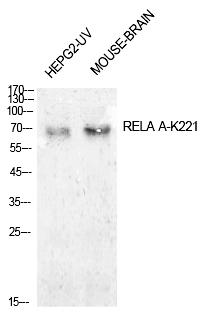 NFκB-p65 (Acetyl-Lys221) Polyclonal Antibody