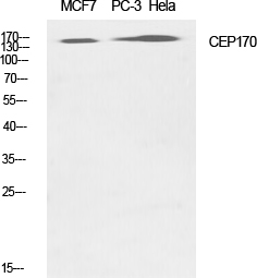 CEP170 Polyclonal Antibody