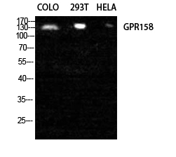GPR158 Polyclonal Antibody