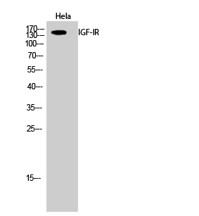 IGF-IR Polyclonal Antibody