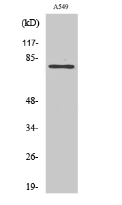 PFK-B Polyclonal Antibody