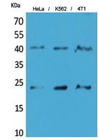 TMEM173 Polyclonal Antibody