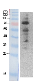 Ub Polyclonal Antibody