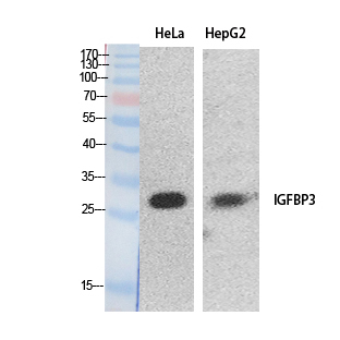 IGFBP3 Polyclonal Antibody