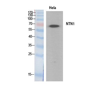 Netrin-1 Polyclonal Antibody