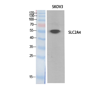 Glut4 Polyclonal Antibody
