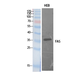 FAS Polyclonal Antibody