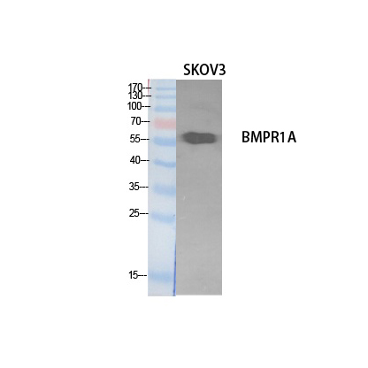 CD292 Polyclonal Antibody