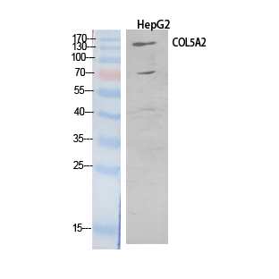 COL5A2 Polyclonal Antibody