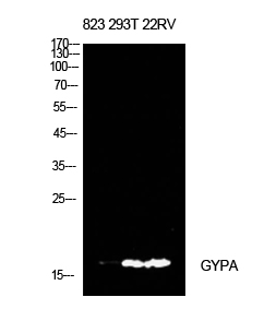 CD235a Polyclonal Antibody