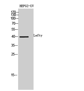 Lefty Polyclonal Antibody