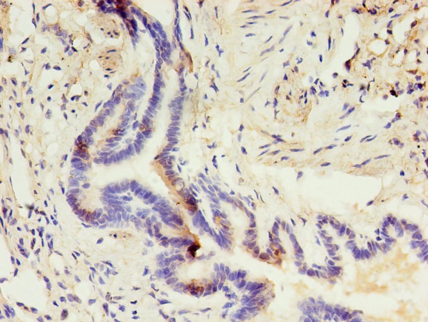 CD14 Monoclonal Antibody