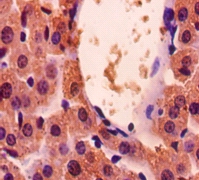 Glyceraldehyde-3-phosphate dehydrogenase Polyclonal Antibody