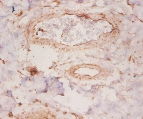 Rho GDP-dissociation inhibitor 1 Polyclonal Antibody