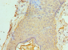 ACTL6B Polyclonal Antibody