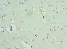 ACTL6B Polyclonal Antibody