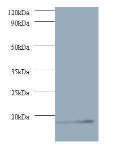 V-type proton ATPase subunit G 1 Polyclonal Antibody