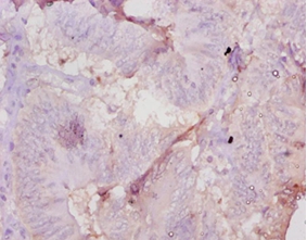 Muellerian-inhibiting factor Polyclonal Antibody
