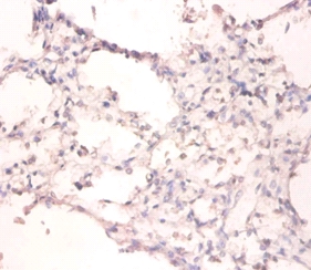 DNA-(apurinic or apyrimidinic site) lyase Polyclonal Antibody