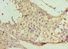NAA10 Polyclonal Antibody