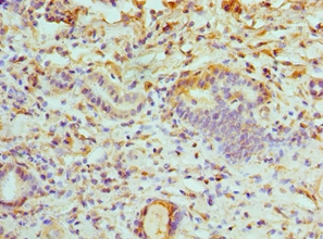 ATP6V1B1 Polyclonal Antibody