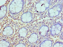 AZU1 Polyclonal Antibody