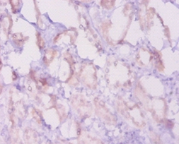 Apoptosis regulator Bcl-2 Polyclonal Antibody