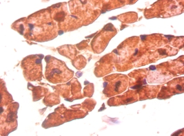 Bone morphogenetic protein 3 Polyclonal Antibody