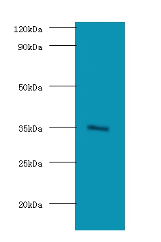 Lys-63-specific deubiquitinase BRCC36 Polyclonal Antibody