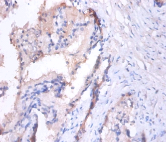Spliceosome RNA helicase DDX39B Polyclonal Antibody