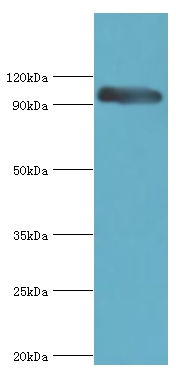 CAPN3 Polyclonal Antibody