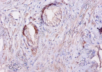 Calpastatin Polyclonal Antibody