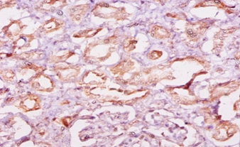 Calpastatin Polyclonal Antibody