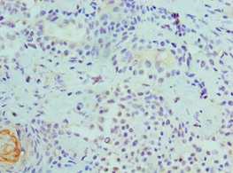 CDK8 Polyclonal Antibody