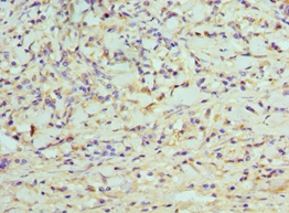 CDK8 Polyclonal Antibody