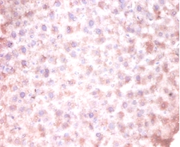 CDKN2AIP N-terminal-like protein Polyclonal Antibody