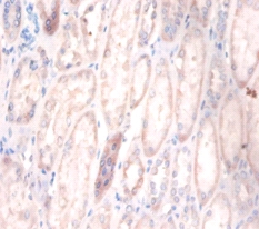 Cerebellar degeneration-related protein 2 Polyclonal Antibody