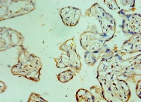 CEBPG Polyclonal Antibody