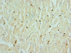 CHRM3 Polyclonal Antibody