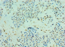 CLIC4 Polyclonal Antibody