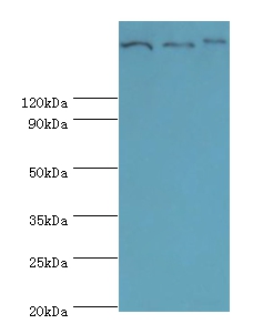 Clathrin heavy chain 2 Polyclonal Antibody