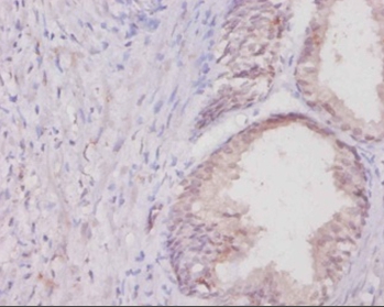 Collagen alpha-1(I) chain Polyclonal Antibody