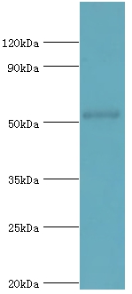 COPS2 Polyclonal Antibody