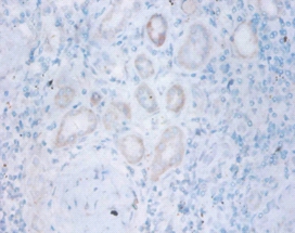 Thiopurine S-methyltransferase Polyclonal Antibody