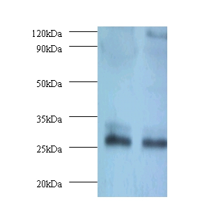 Thiopurine S-methyltransferase Polyclonal Antibody