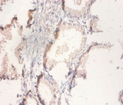 Citrate synthase, mitochondrial Polyclonal Antibody